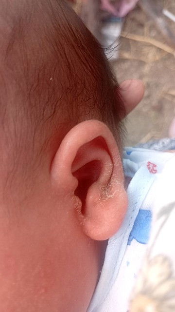 เเบบนี้ปกติไหมค่ะ