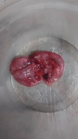 MENGANDUNG TAPI PERIOD