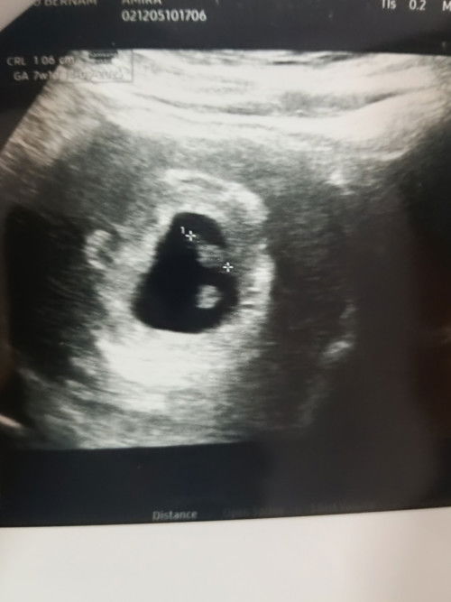 Nak tanya ni betul ke kembar