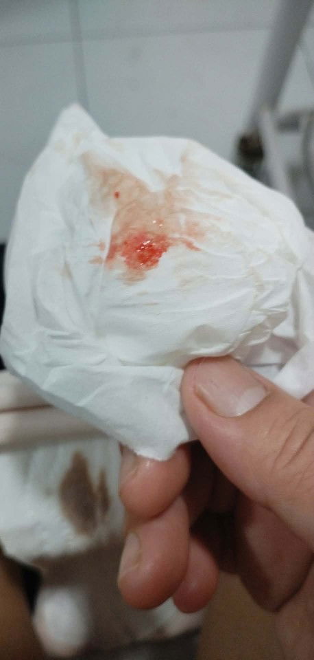 12weeks pregnant have spotting but no pain it is normal