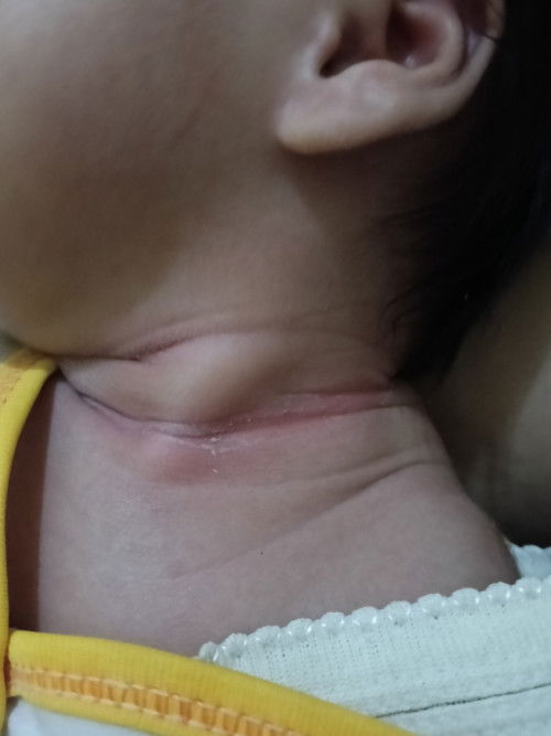 Dibagian lipatan memerah