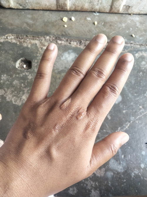 อาการเก่ายังไม่หายอาการใหม่มีอีก