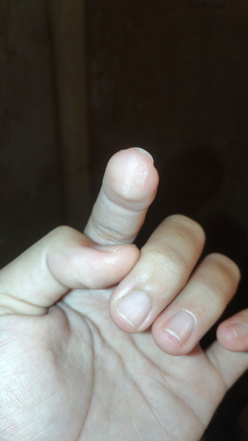 Keluar Lendir ( pregnant 36weeks+ )