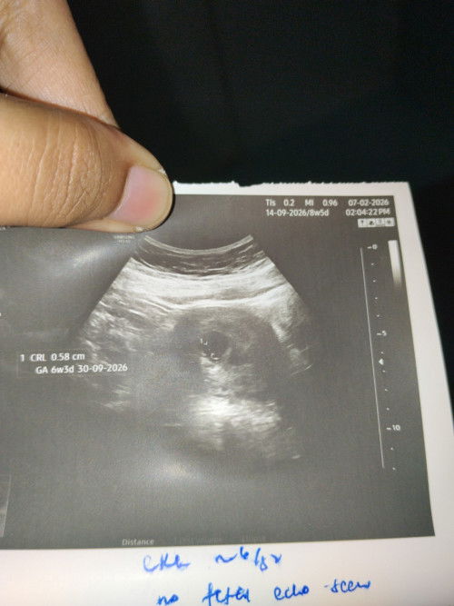 Kiraan usia kandungan