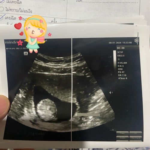 มาแชร์ประสบการณ์อัลตร้าซาวน์ครั้งแรกกันค่ะ