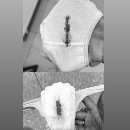 Pembukaan tanpa kontraksi