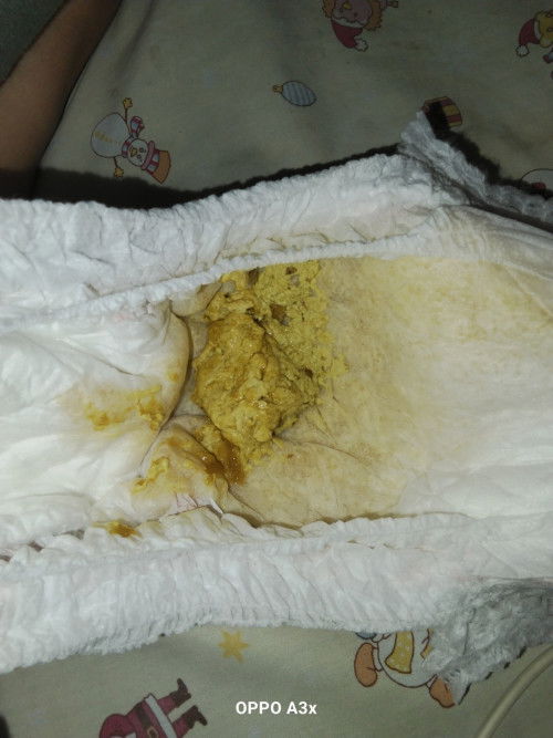 1 ขวบ 8 เดือน ถ่ายเหลว