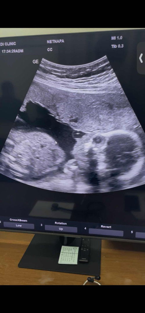 ปกติมั้ยคะแม่ๆ