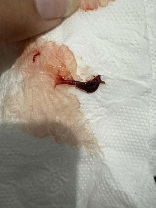 แท้งไหมค่ะแบบนี้