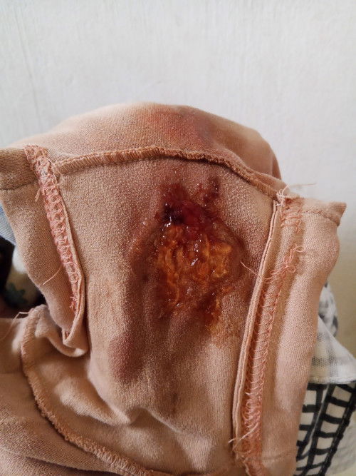 37 weeks and 2 days 4-5 cm no pain no contractions ano pa po pwede gawin para tumaas na ang cm