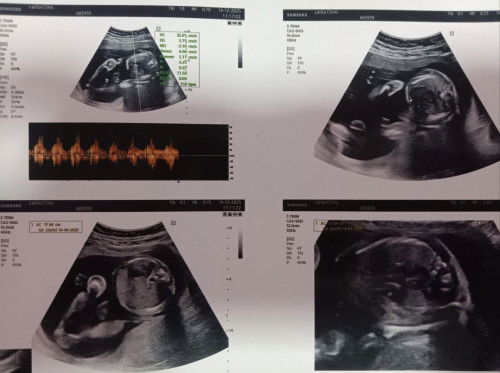 บ้านนี้30วีค5วัน น้องน้ำหนัก 1763 กรัม ทีมเมษา ลูกชาย บ้านไหนน้องน้ำหนักเท่าไหร่กันบ้างแล้วคะ