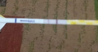 Saya di Diagnosa SPOG Susp hamil BO(hamil kosong) atau janin tidak berkembang.