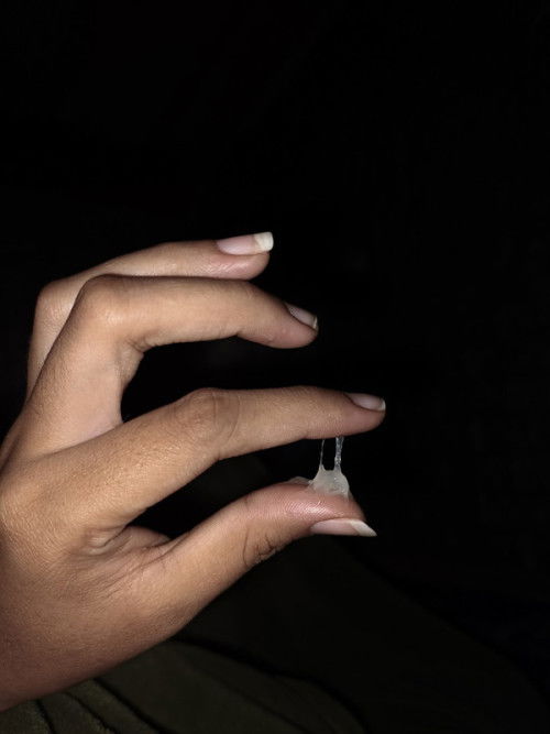 มูกใสหรือตกขาวคะ