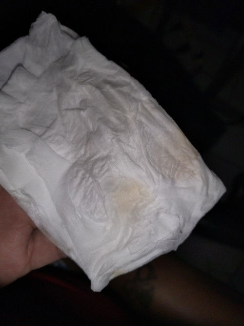 มีสีเเบบนี้ผิดปกติไหมค่ะ