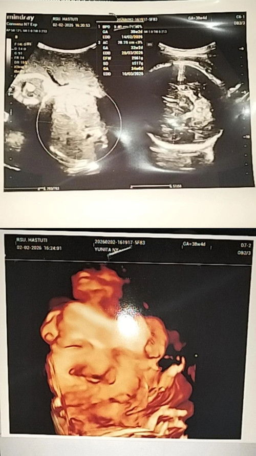 Bunda-bunda mau tanya dongs tips biar agar gelombang cinta cepat datang sekarang udah 39week4hari🥲