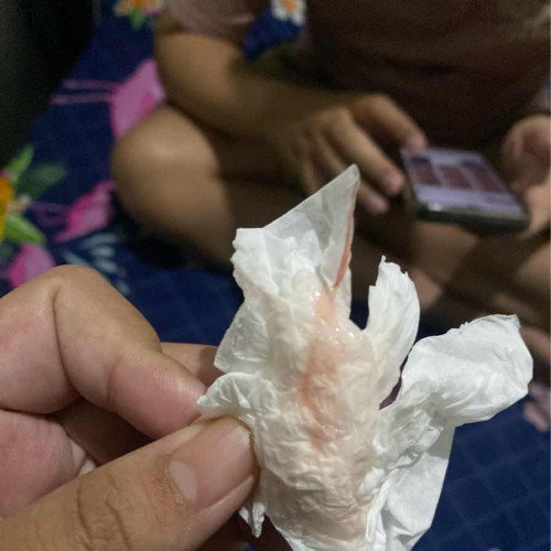 Lendir campur darah