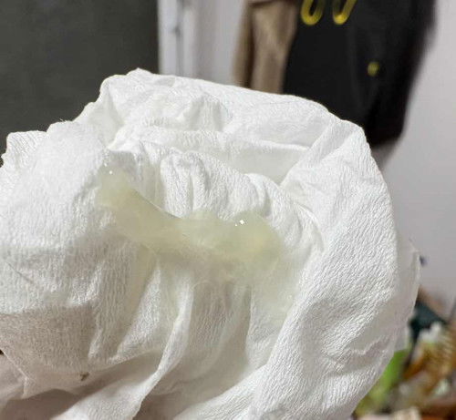 32 วีคมีมูกใสๆออกปกติมั้ยค่ะ