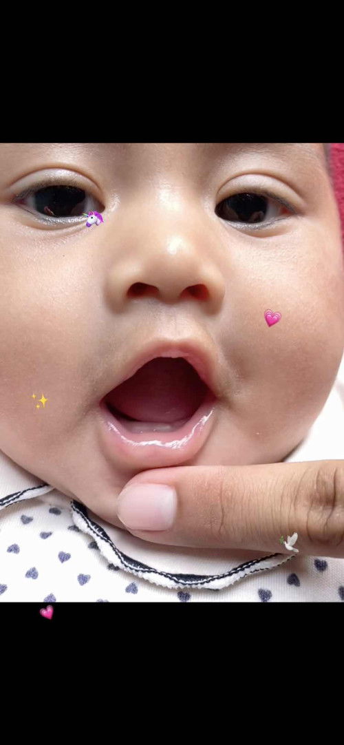 Bayi 4bulan sudah tumbuh gigi