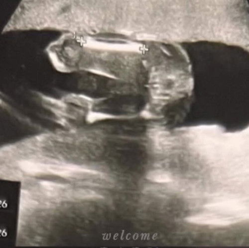 ดูออกไหมคะ ว่าเพศอะไร