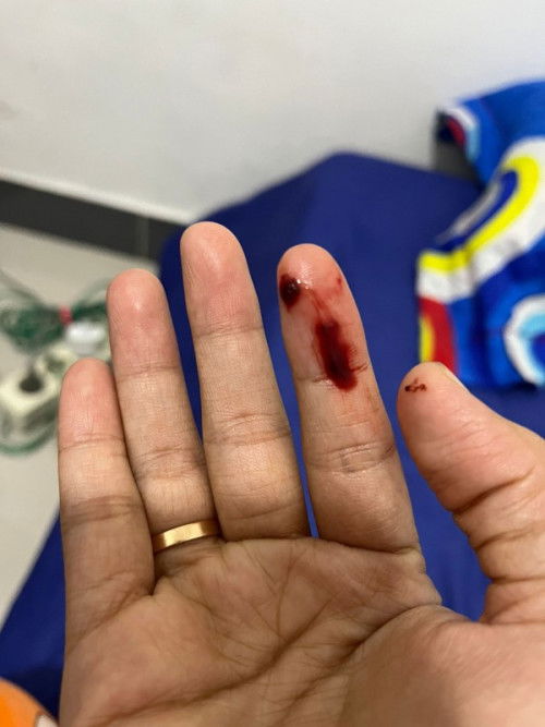 Pendarahan di usia kehamilan 6 minggu