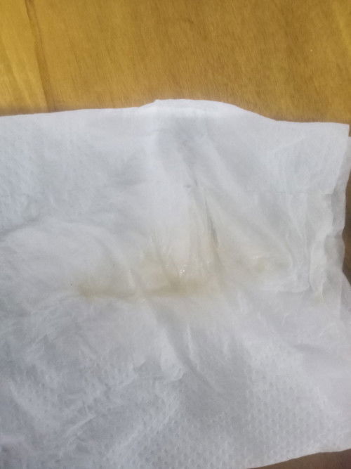 Hellow po mims ask ko lng ko I am 38weeks po my lumbas sakin kulay yellow na prang light brown ano 2