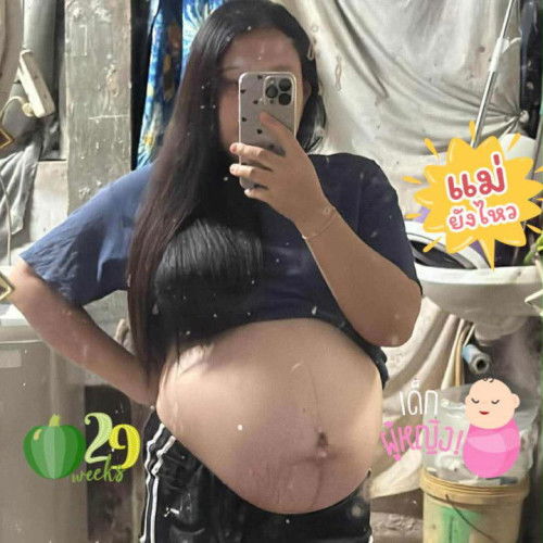 29+5W ท้องแรก เพศหญิง🤍👧🏻