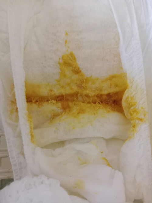 มาคุยกันเรื่องสีอุจจาระของลูกน้อย