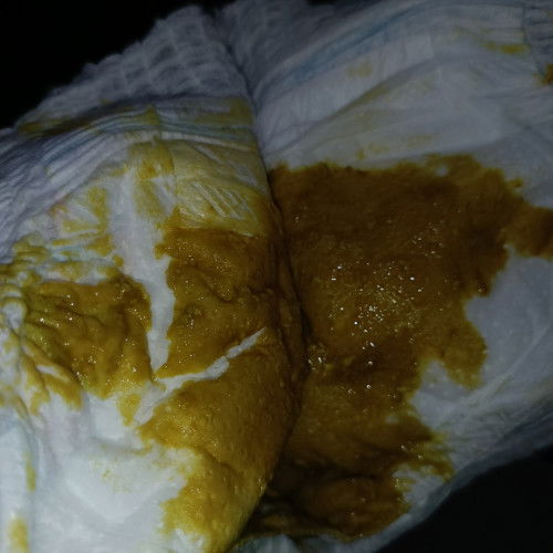 นมผงดูเม็กซ์