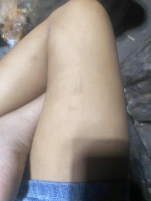 บ้านไหนเป็นบ้างคะ19+2w