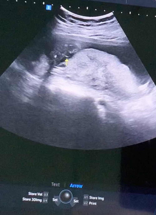 ผู้หญิงหรือผู้ชายค่ะ