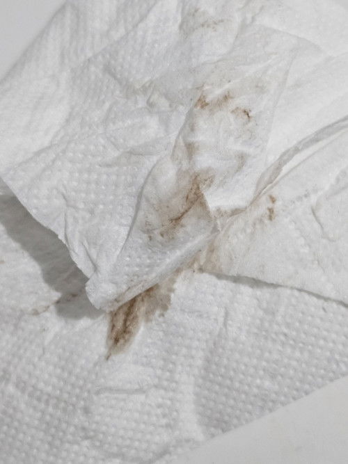 ตั้งครรภ์ 11 วีค มีเลือดออกสีน้ำตาลเมื่อวานมีอาการปวดท้องแต่วันนี้ไม่มีแล้ว อันตรายไหมคะ