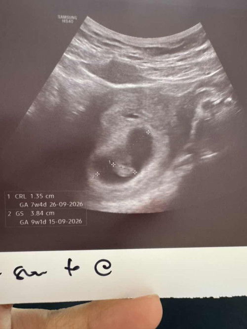 Kiraan weeks tak sama