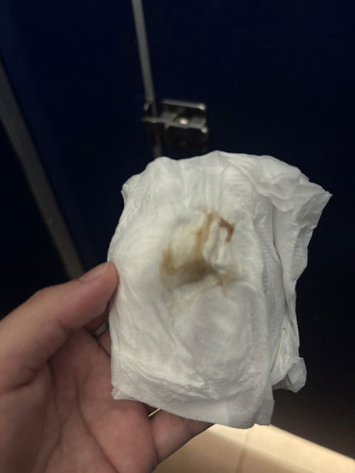 มีมูกเลือดออก