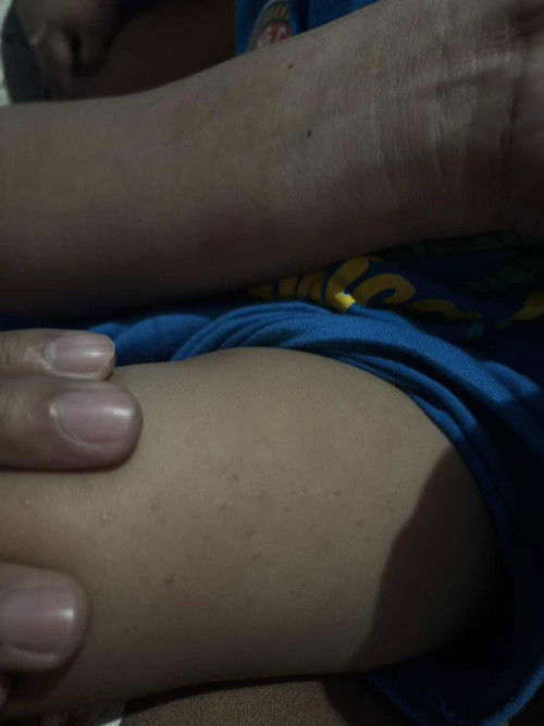 Skin Bumps or rashes???