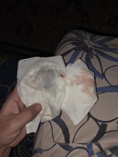 Sorry nk tanya 39 week 4 day hari kedua mcm ni nak kne pegi pac ke ?