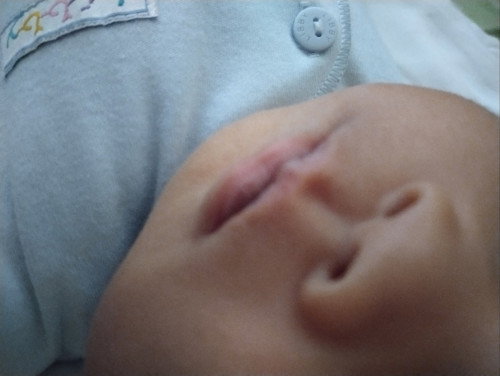 Baby bibirnya dua warna itu knpa nya
