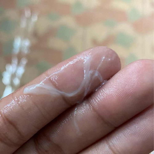 มูกใส หรือ ตกขาวคะแบบนี้ 39+4 
ไม่มีอาการปวดท้อง