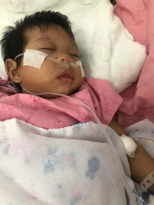 ปอดอักเสบ จากการสำลักนม