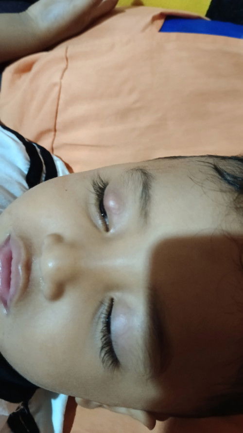 Mau tanya seputar anak