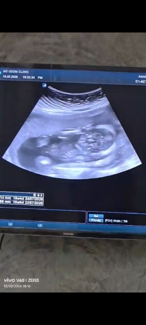 ช่วยดูเพศลูกให้หน่อยค่ะ