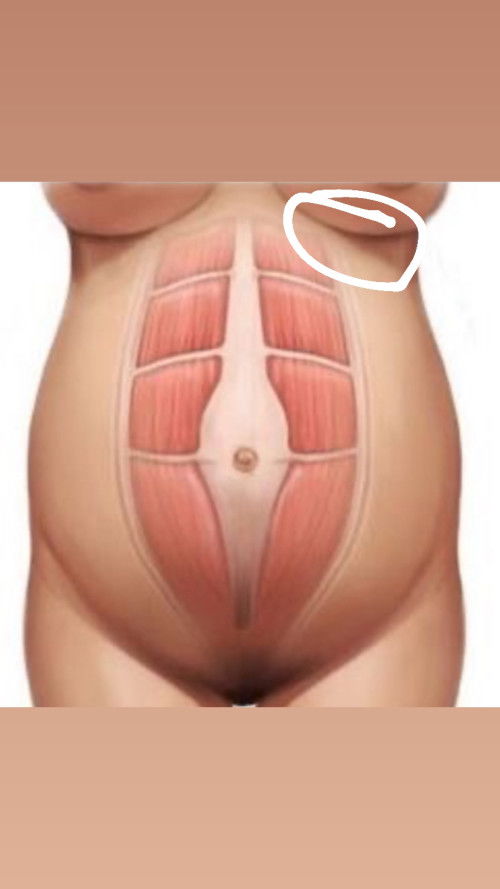 เวลานอนชอบปวดตรงนี้