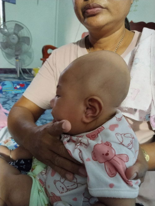 น้องหัวแบนไหมคะ