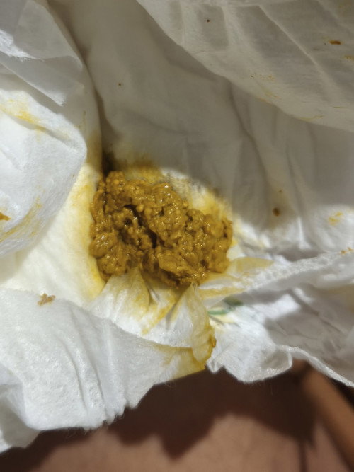 อึปกติมั้ยนมชง+นมแม่