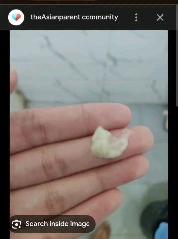 Normal ba na may lumalabas sakin na ganto. 13weeks preggy . And nagtetake ng antibiotic dhl sa uti