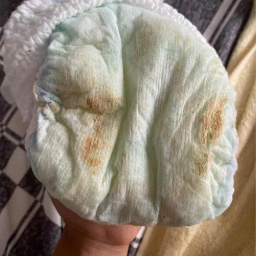 Pipis bayi bergerindil