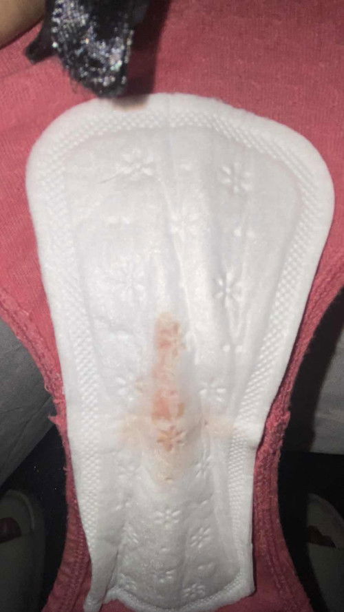 spotting 8 weeks preggy