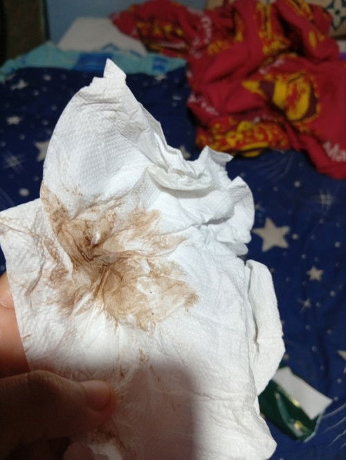 สวัสดีค่ะคุณแม่พอดีท้องได้7 สัปดาห์ค่ะแต่เมื่อเช้ามีน้ำออกมากจากช่องคลอดแบบนี้จะเป็นไรมั้ยค่ะท้องแรก