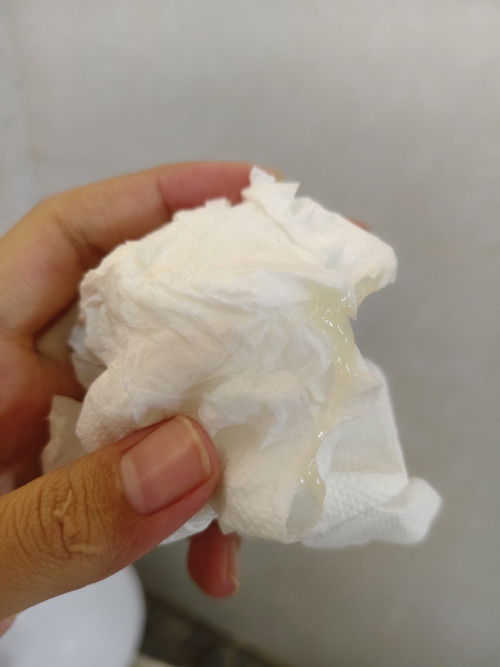 ตอนนี้ได้ 35+3 weeks