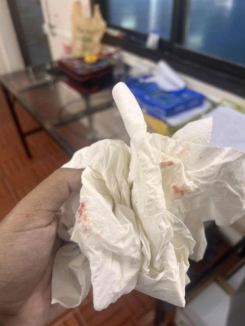 มีเลือดติดกระดาษทิชชูระหว่างเช็ด