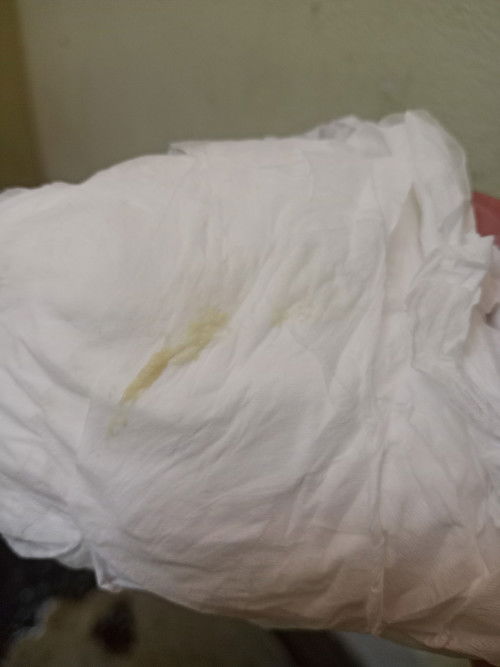 ตกขาวสีเขียวอ่อน